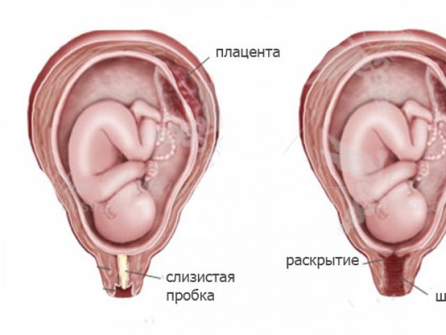Пробка при беременности: функции и особенности отхождения перед родами